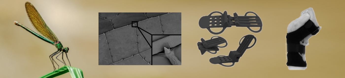 3D printed splint 3D printed splint